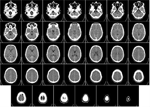 What diagnostic imaging is